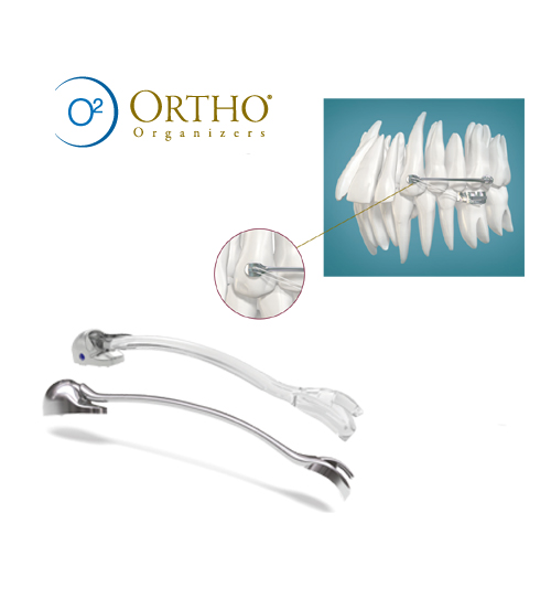 ORTHO Carriere Motion Class II Appliance